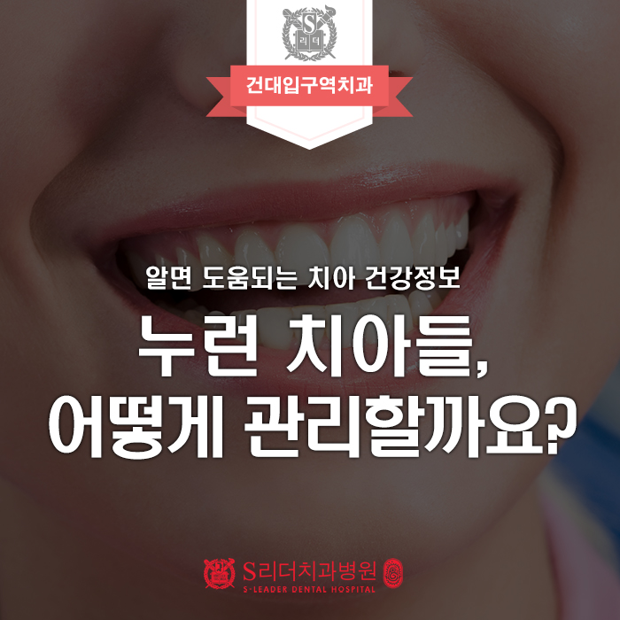 Myeonmok-dong Dental Clinic: How Should You Manage Yellow Teeth? image 1