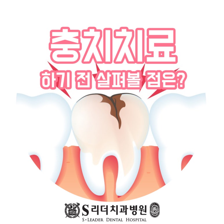 성수동치과 치과충치치료 정직한 서울치과병원에서 관련 이미지 1