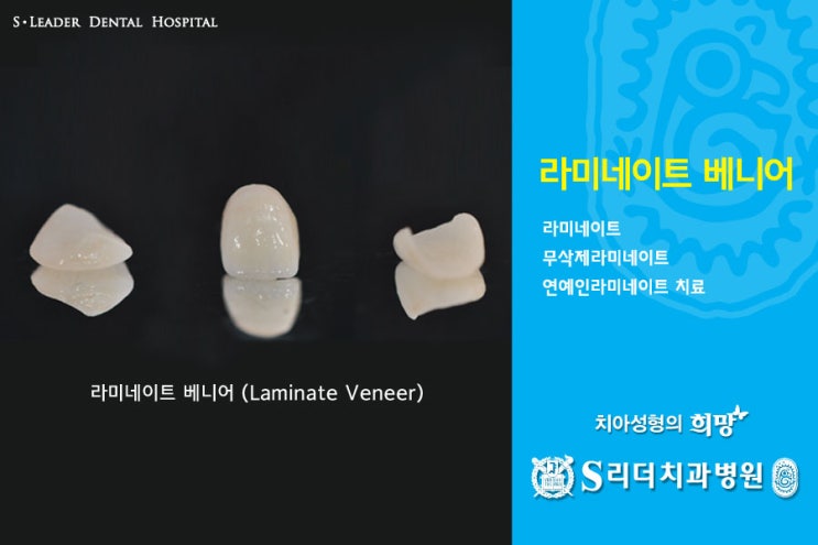 건대치과 치아성형 잘하는 곳 궁금해? 관련 이미지 4