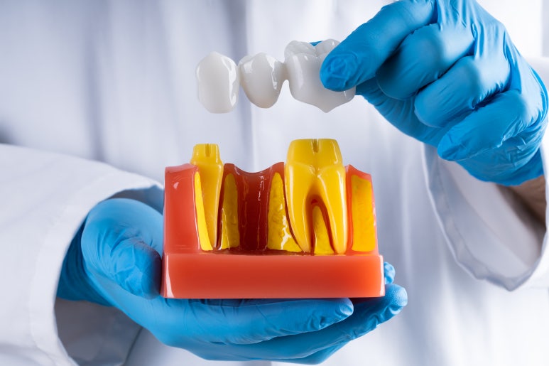 Sanggye-dong Implants | Why Bone Grafting Is Needed When There Is Not Enough Jawbone image 5