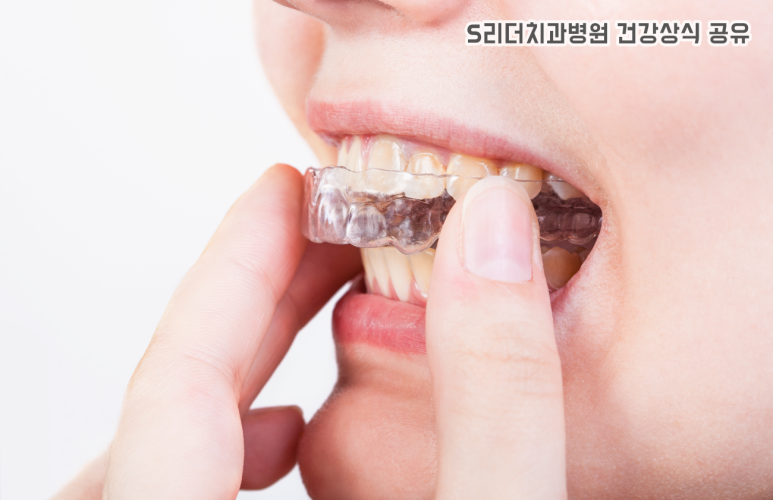 예뻐지는 방법 성형만이 정답이 아닌 이유 관련 이미지 2
