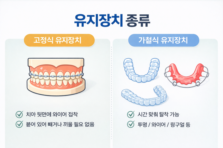 Junggok-dong Dental Clinic: Do You Have to Wear a Retainer for Life After Orthodontic Treatment? A Complete Guide to Retainer Duration image 6