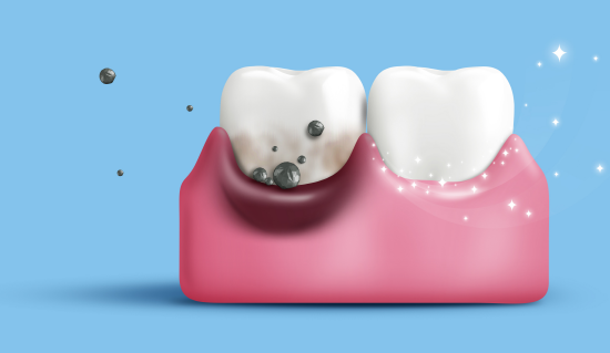 3 Things to Check When Considering Implants at Sagajeong Dental Clinic image 6