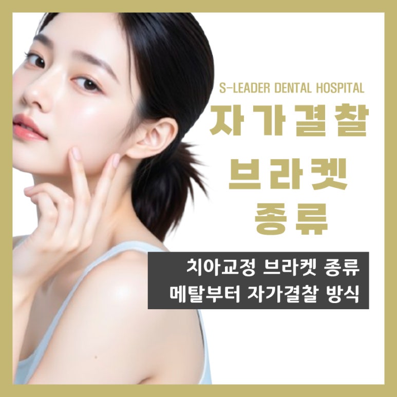 중곡동치과, 자기결찰 브라켓 종류 고민될 땐. 관련 이미지 1