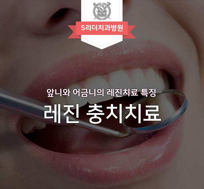 레진 충치치료 앞니와 어금니 둘다 알아보자 관련 이미지 1