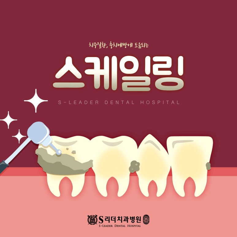 Dongdaemun-gu Dental Clinic｜Is Scaling Enough? A Complete Guide to Why Gum Treatment May Also Be Needed image 1