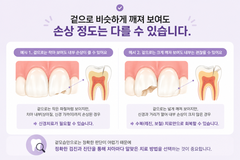 군자동치과 앞니 여러 개가 동시에 깨졌다면? 치아마다 치료 방법이 다른 이유 관련 이미지 3