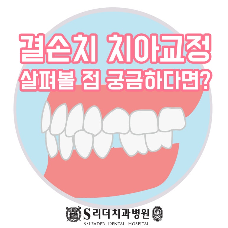 광진구교정치과 결손치치아교정 잘하는치과에서 살려볼점은 관련 이미지 1