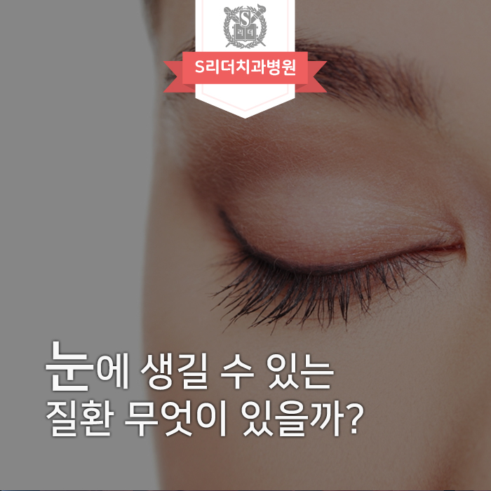 안질환 종류와 눈에 대한 여러가지 정보 관련 이미지 1