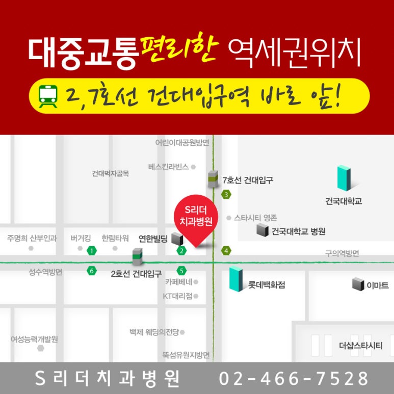 건대치과 임플란트 잘하는 곳으로 가즈아~ 관련 이미지 6