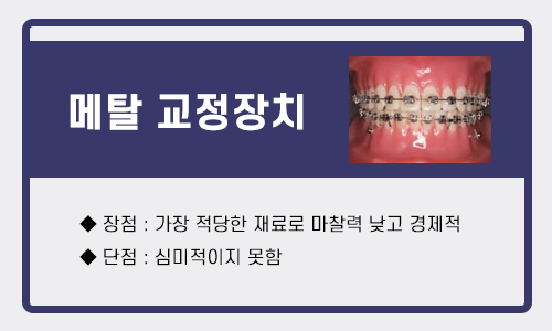 건대입구교정치과 각 교정장치의 장단점 관련 이미지 2