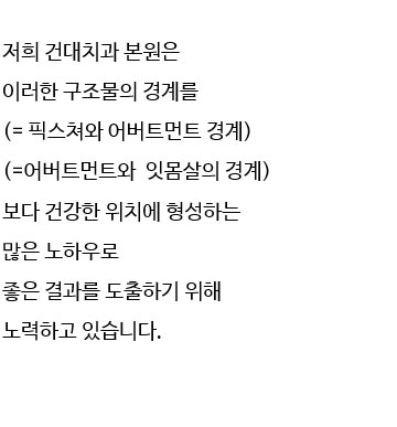 광진구치과 임플란트 단점정리 관련 이미지 15