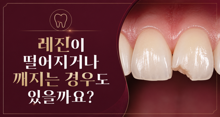 송정동치과, 앞니 레진은 얼마나 오래 사용할 수 있을까요? 관련 이미지 5