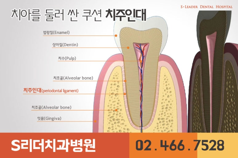 광진구교정치과 교정할때의 통증... 관련 이미지 2