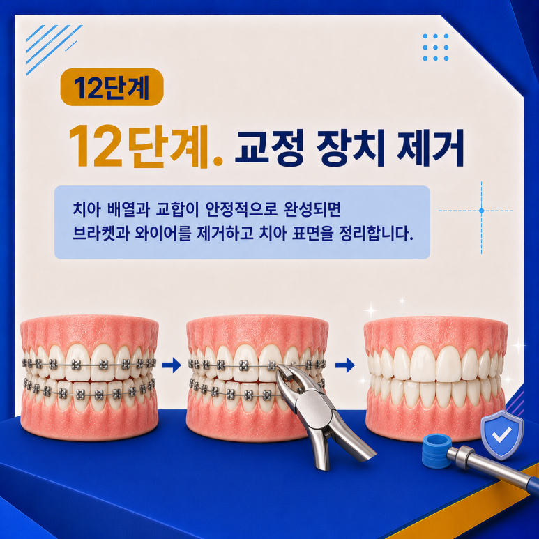 군자역치과 치아교정은 어떤 순서로 진행될까요? 단계별 과정 정리 관련 이미지 13