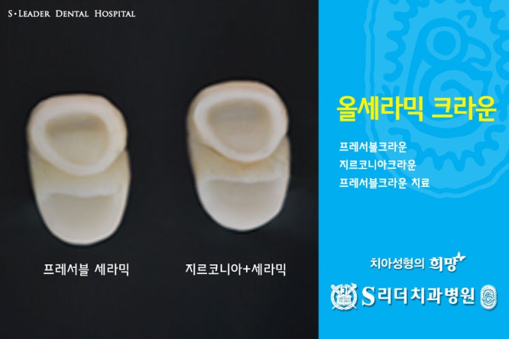 건대치과 치아성형 잘하는 곳 궁금해? 관련 이미지 8