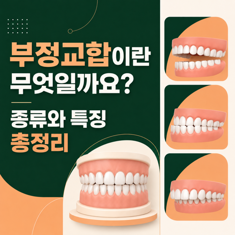 Konkuk University Station Dental Clinic: What Is Malocclusion? A Complete Overview of Its Types and Characteristics image 1