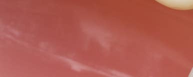 면목역치과 이갈이 하면 안좋은 점, 뭐가 있을까요? 관련 이미지 7