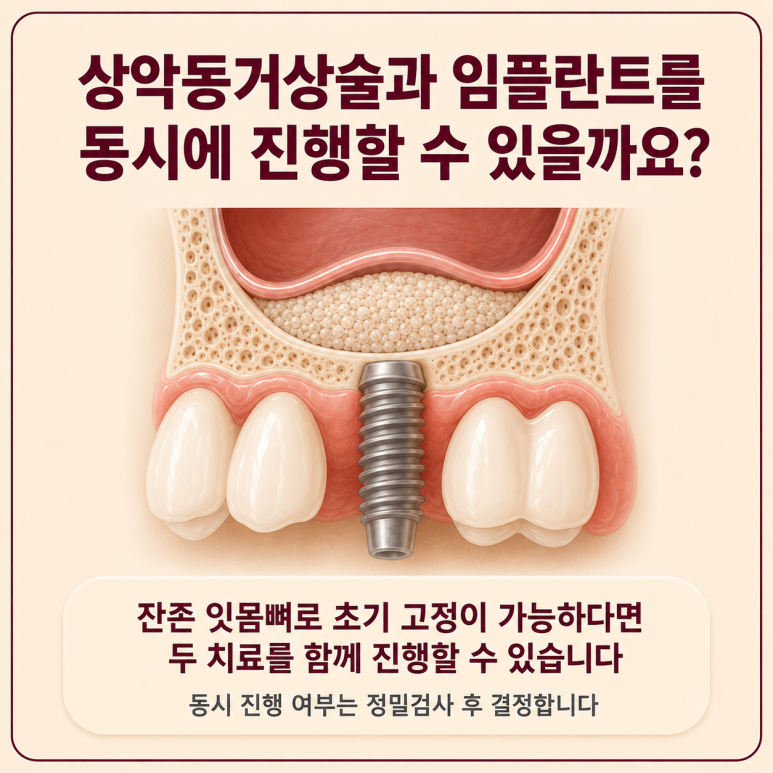 송정동치과 잇몸뼈가 부족하면 상악동거상술을 꼭 해야 할까요? 관련 이미지 6