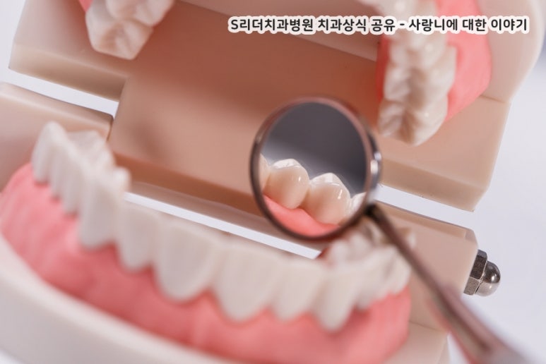 사랑니 필요성 사랑니는 쓸모없는 치아가 아니다? 관련 이미지 3