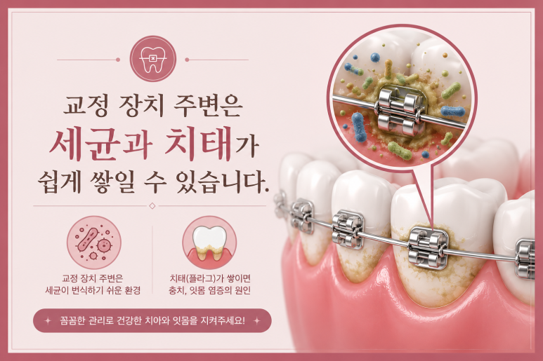서울치아교정잘하는곳|교정 중 잇몸이 안 좋아지는 원인과 관리법 관련 이미지 2