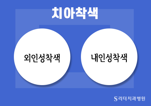 건대미백 치과 치아착색을 일으키는 식품 관련 이미지 2