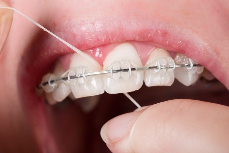 If Your Gums Are Weak, Is Implant or Orthodontic Treatment Possible? Dental Diagnosis Criteria in Dongdaemun-gu image 6