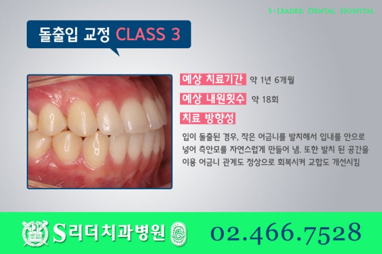 건대교정치과 똑같은 돌출입치아교정이 아니라는 점. 관련 이미지 7