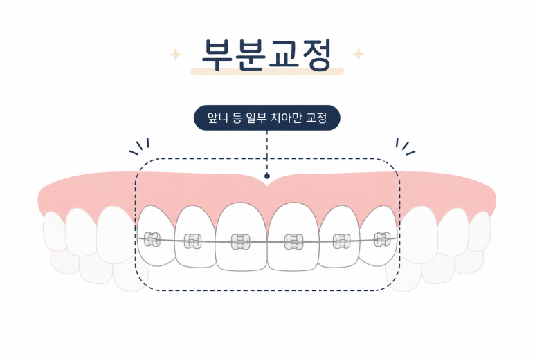 사가정역치과, 부분교정으로 가능한 경우와 어려운 경우는? 관련 이미지 3