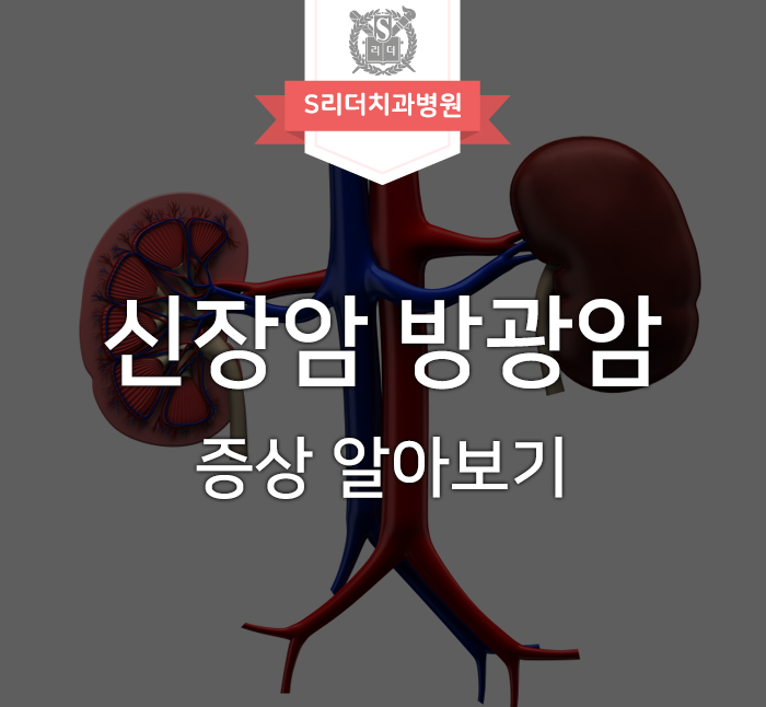 신장암 방광암 증상과 이것을 진단하는 검사 방법들 알아보기 관련 이미지 1