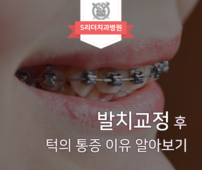 발치교정 통증, 턱관절 장애를 일으킬 수 있다? 관련 이미지 1