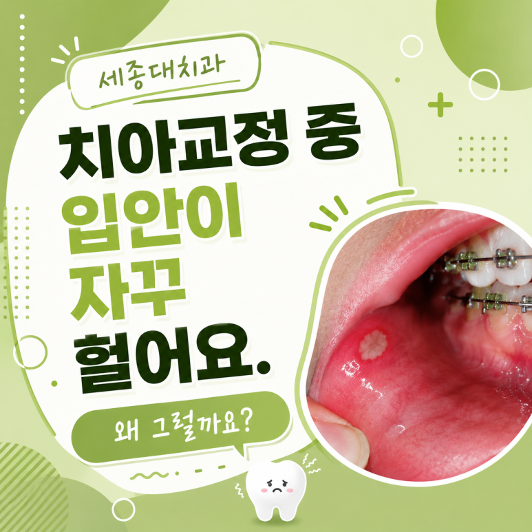세종대치과, 치아교정 중 입안이 자꾸 헐어요. 왜 그럴까요? 관련 이미지 1