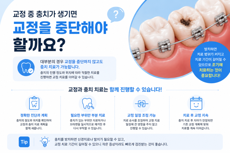 How Is a Cavity Treated If It Develops During Orthodontic Treatment at Neungdong Dental Clinic? image 3