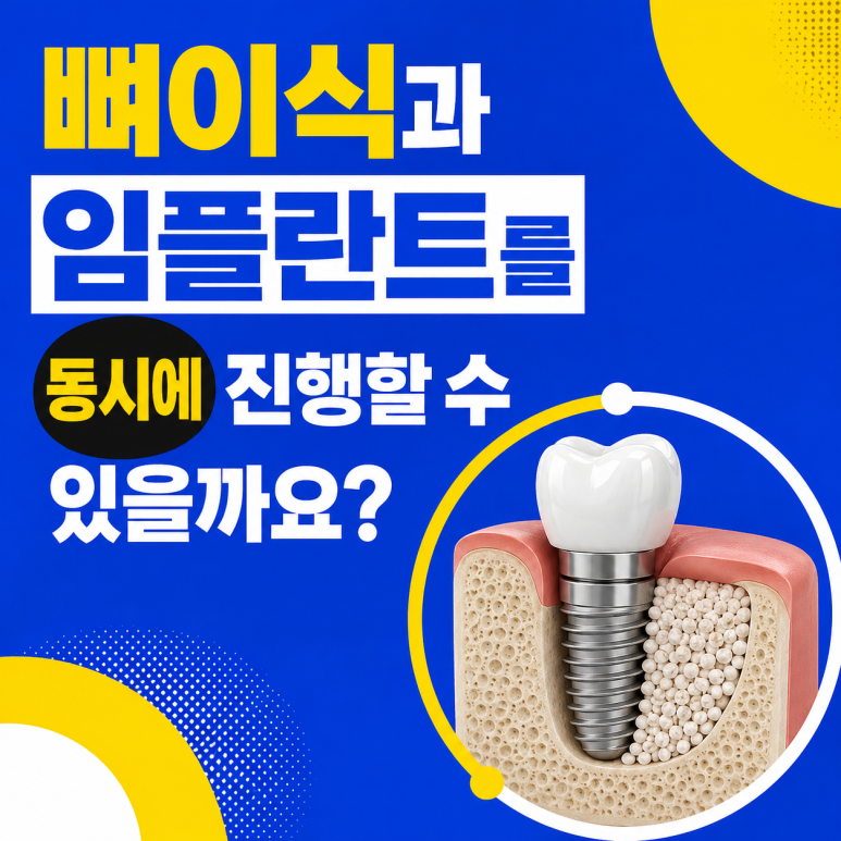 Hwanyang-dong Dental Clinic: Can Bone Grafting and Implant Placement Be Performed at the Same Time? image 1