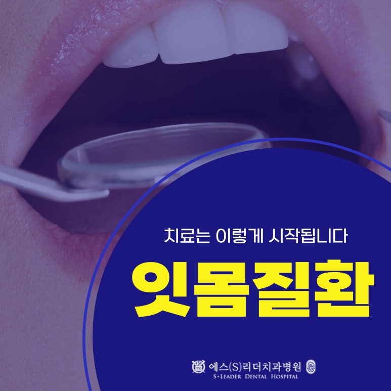 중랑구치과, 잇몸질환 치료는 어떻게 진행되나요? 관련 이미지 1