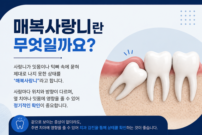 건대입구치과, 매복 사랑니가 옆 치아에 영향을 줄 수도 있을까요? 관련 이미지 2