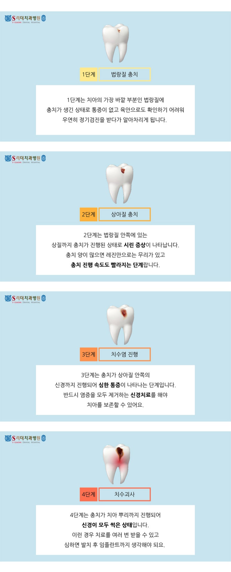 성수동치과 치과충치치료 정직한 서울치과병원에서 관련 이미지 22