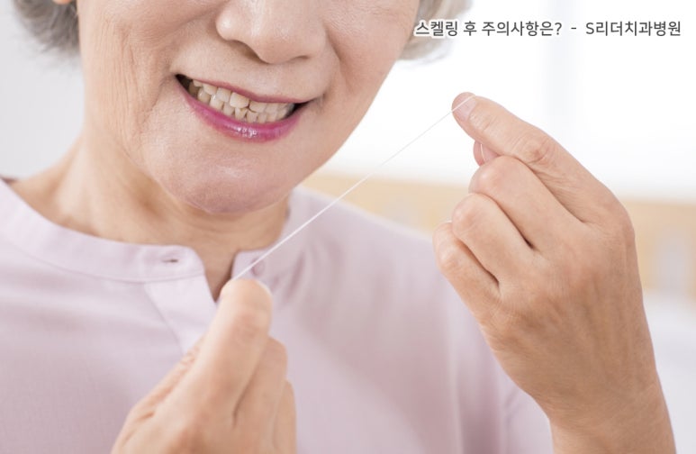 스켈링 후 주의사항, 스켈링에 대한 오해 알아보기 관련 이미지 5