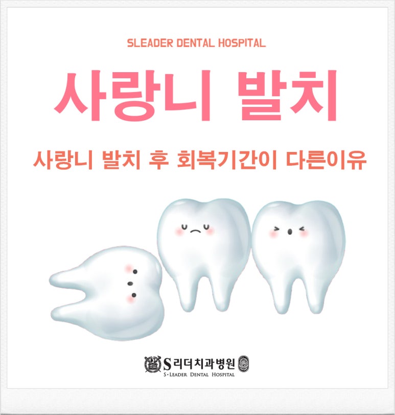구의동치과, 사랑니 발치 후 회복 기간이 달라지는 이유 관련 이미지 1
