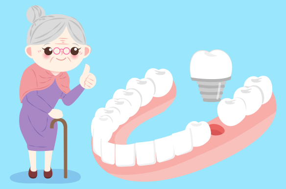 3 Things to Check When Considering Implants at Sagajeong Dental Clinic image 9