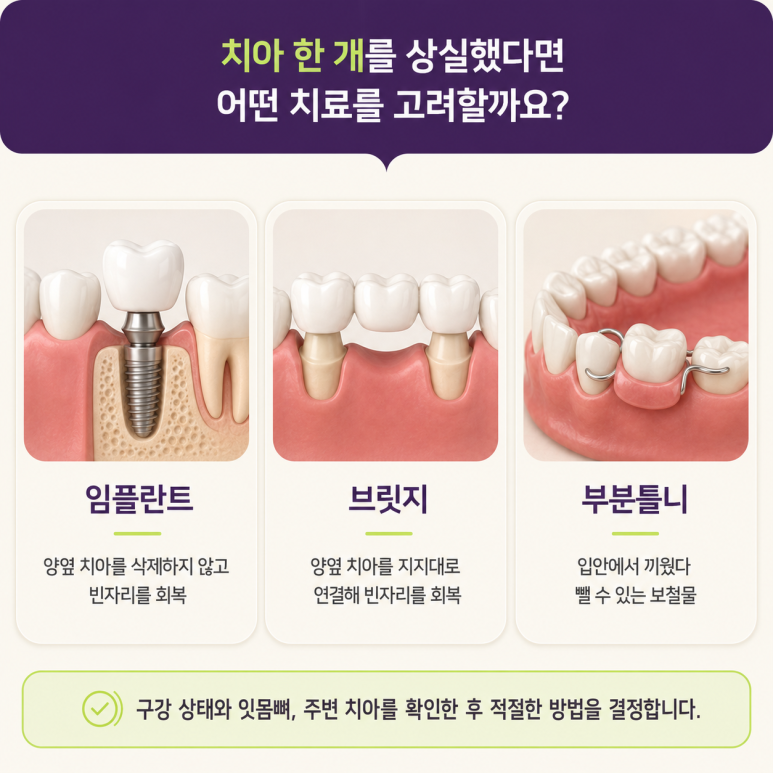 성수동임플란트, 치아 상실 후 임플란트·브릿지·틀니 어떤 차이가 있을까? 관련 이미지 10