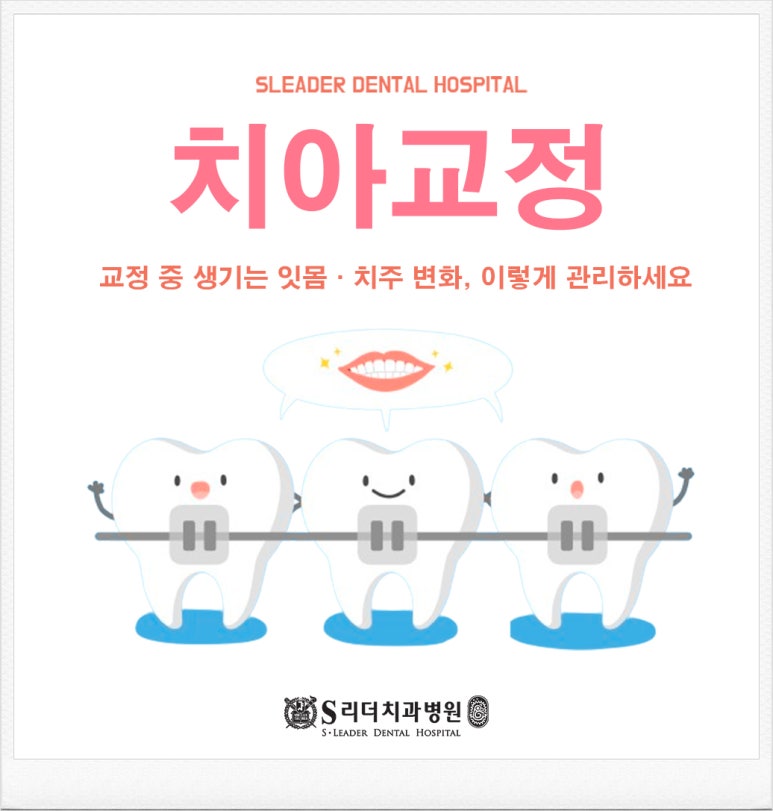 Seoul orthodontics: How to manage gum and periodontal changes during orthodontic treatment image 1