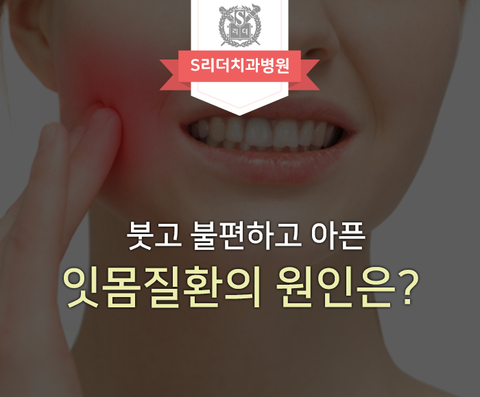 잇몸질환의 원인 중 구조적인 원인은? 관련 이미지 1