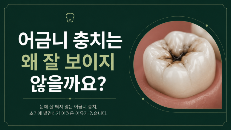 Seoul Famous Dental Clinic: Why It Is Hard to Detect Molars With Cavities Early image 3