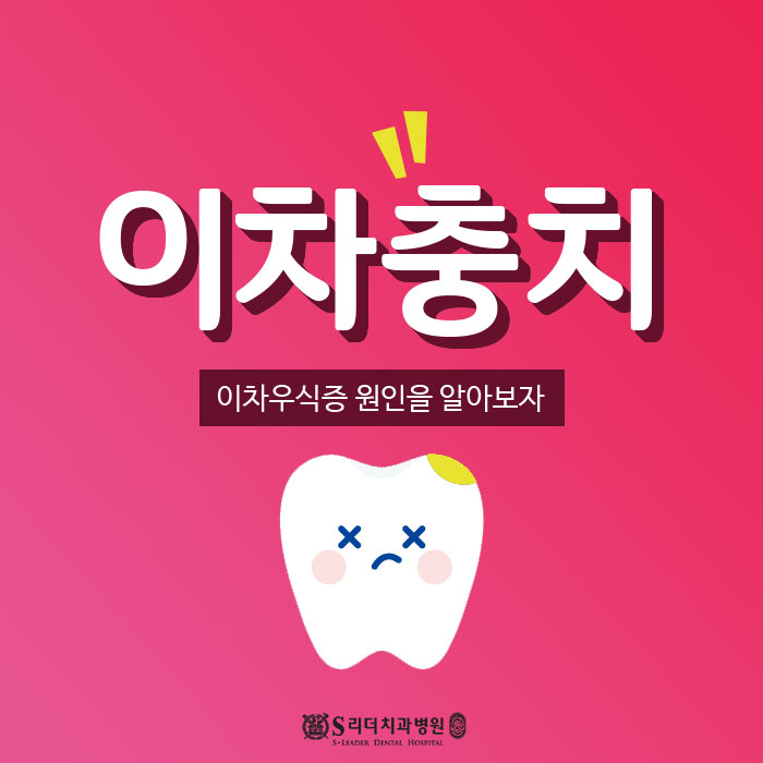 이차충치 이차우식증 원인이 대체 뭐야??? 관련 이미지 1