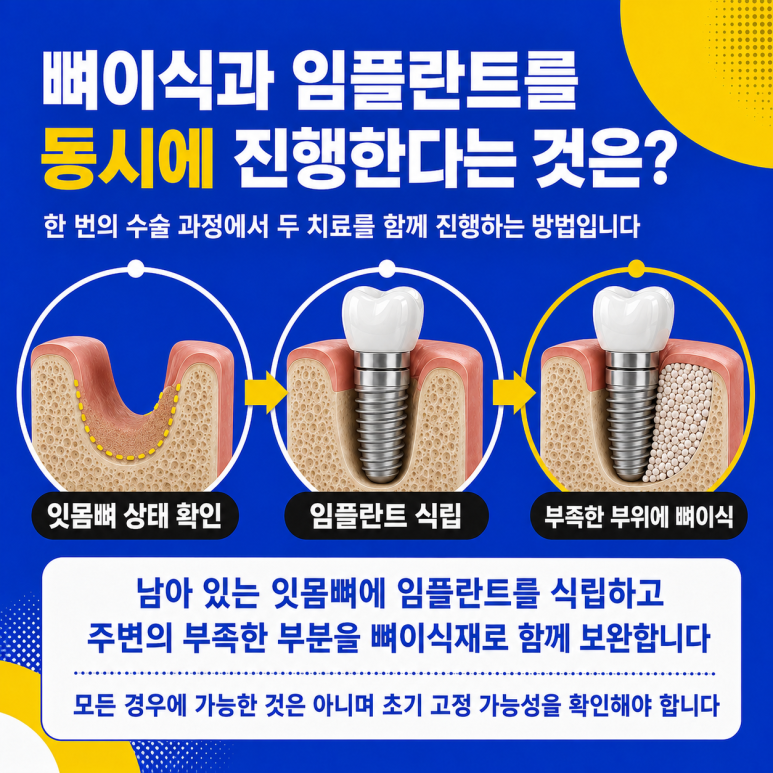 Hwanyang-dong Dental Clinic: Can Bone Grafting and Implant Placement Be Performed at the Same Time? image 3