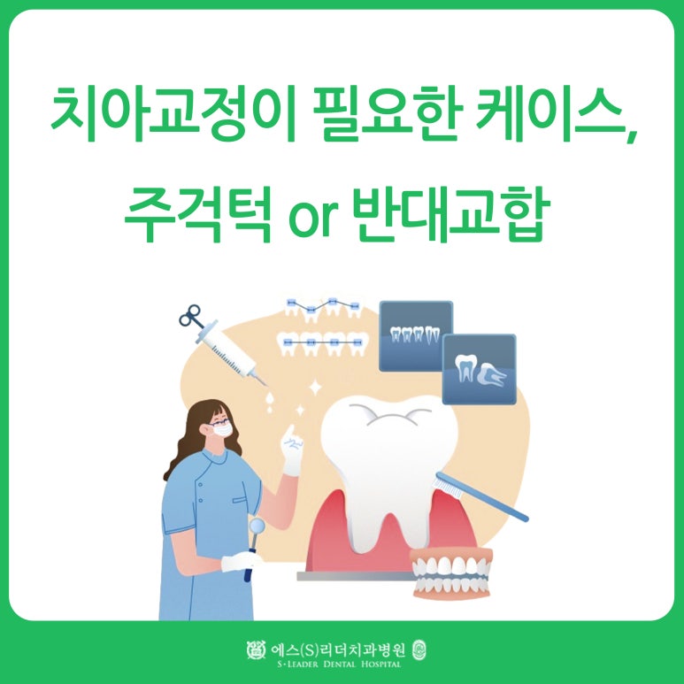 [Mangu-dong Dental Clinic] Cases Requiring Orthodontic Treatment: Protruding Jaw or Crossbite image 1