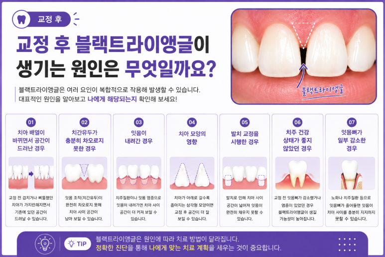 Konkuk University Orthodontics: Do Your Teeth Look Spaced Apart? It Could Be Caused by Black Triangles image 3