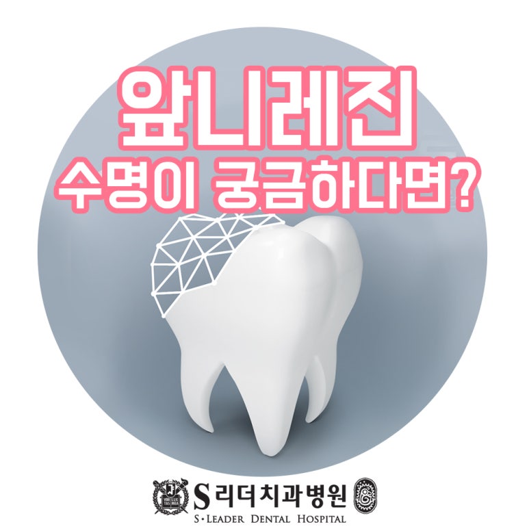 성동구치과 앞니레진수명 관련해 고려해야 할 점은 관련 이미지 1