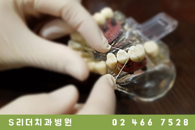 구강관리에 효과적인 치실사용법! 관련 이미지 4